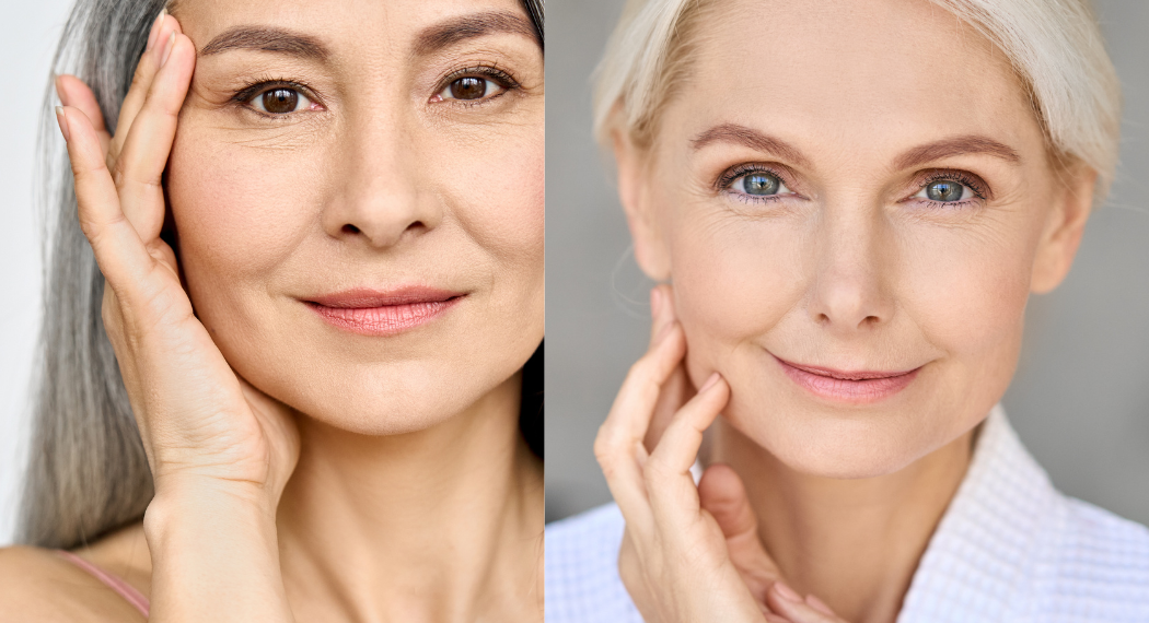 Da thiên dầu hay da khô