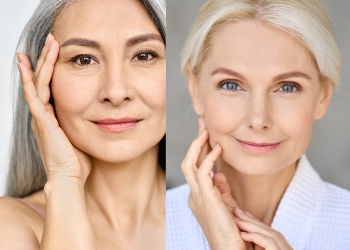 Da thiên dầu hay da khô