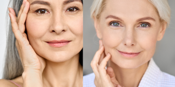 Da thiên dầu hay da khô